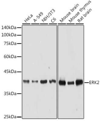 <b>Genetic Strategies Validation. </b>Western Blot: ERK2 Antibody [NBP3-02973] - Western blot analysis of extracts of various cell lines, using ERK2 antibody (NBP3-02973) at 1:1000 dilution. Secondary antibody: HRP Goat Anti-Rabbit IgG (H+L) at 1:10000 dilution. Lysates/proteins: 25ug per lane. Blocking buffer: 3% nonfat dry milk in TBST. Detection: ECL Basic Kit. Exposure time: 10s.